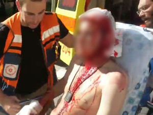 The soldier wounded in Wednesday's stabbing attack in Hebron. Photo: Magen David Adom.