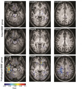 Brain scans